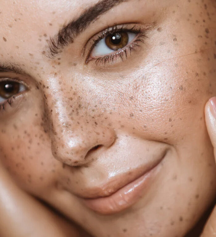 Close-up van een vrouwengezicht met natuurlijke sproeten en glanzende huid.